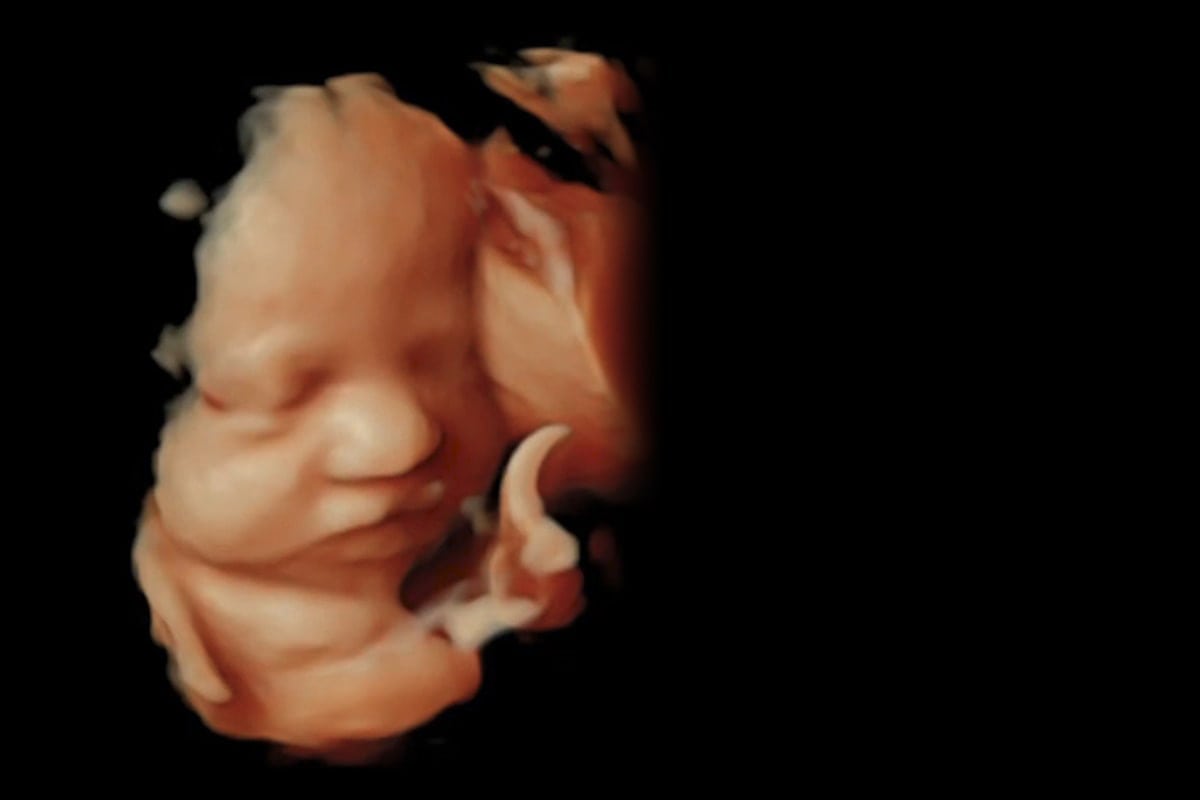 Υπερηχογράφημα Β' Επιπέδου